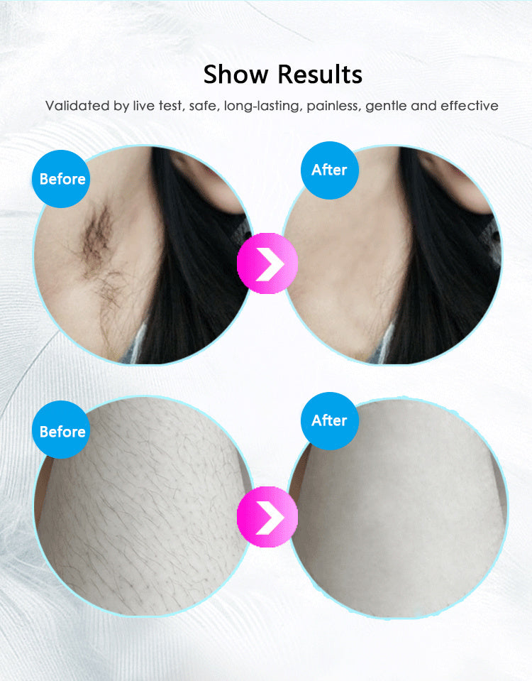 Professional IPL Hair Removal Device
