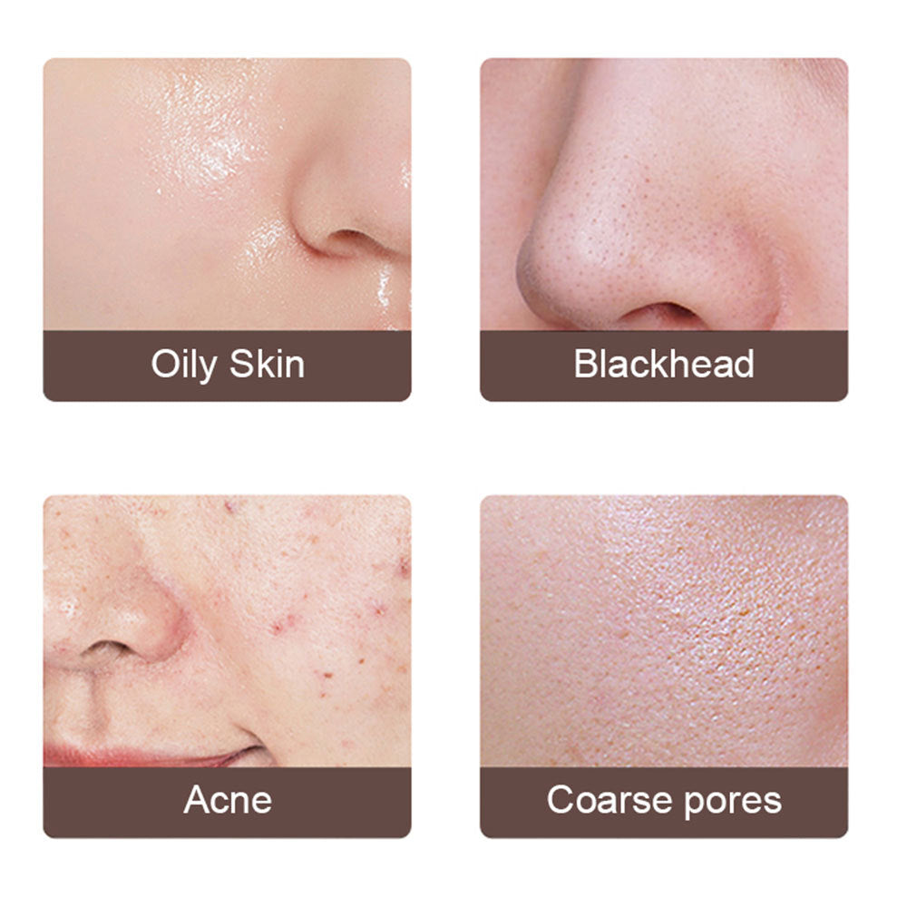 Deep Pore Cleansing & Lifting Tool